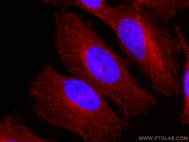 ATG4B Antibody in Immunocytochemistry (ICC/IF)