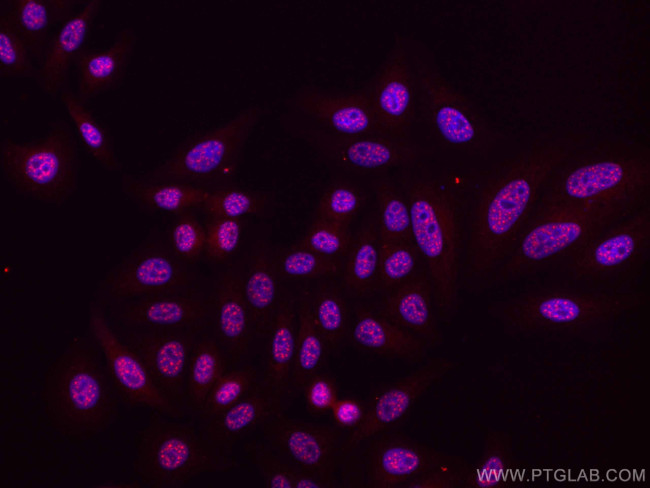 Phospho-mTOR (Ser2448) Antibody in Immunocytochemistry (ICC/IF)