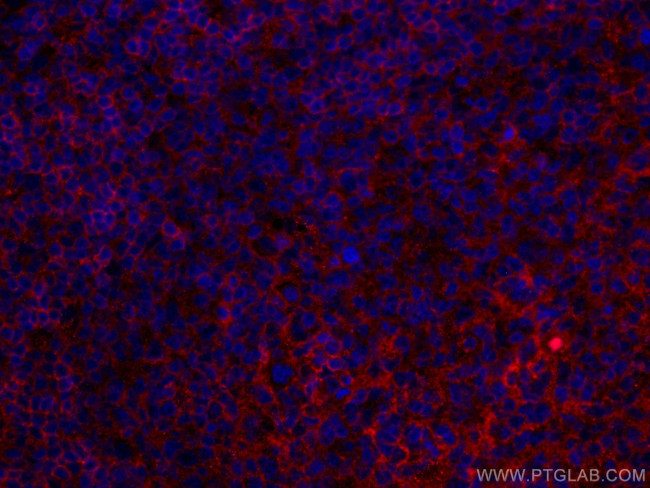 NT5E, CD73 Antibody in Immunohistochemistry (Paraffin) (IHC (P))