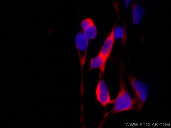 EIF4A2 Antibody in Immunocytochemistry (ICC/IF)