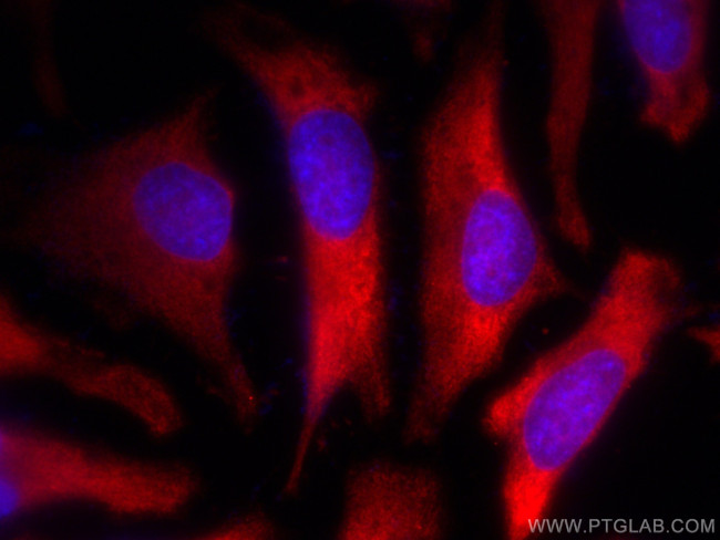 TARS Antibody in Immunocytochemistry (ICC/IF)