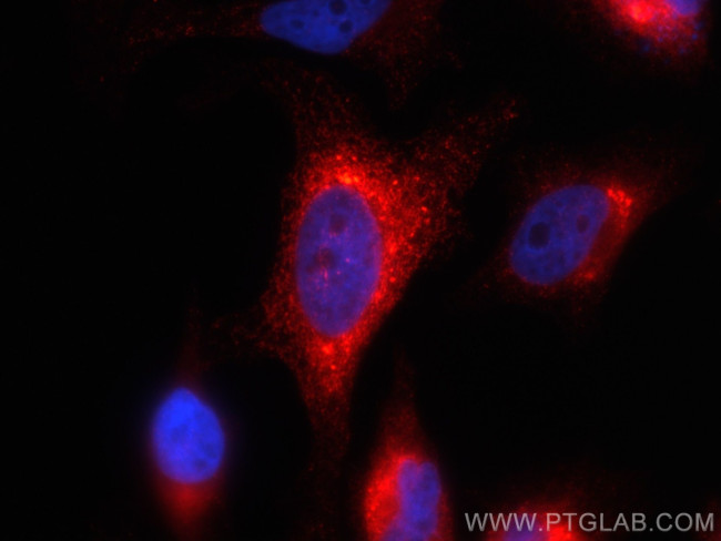 HSP47 Antibody in Immunocytochemistry (ICC/IF)