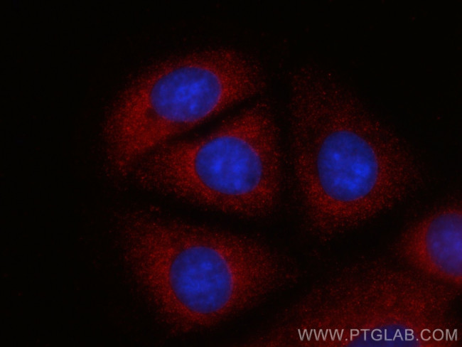 PSME1 Antibody in Immunocytochemistry (ICC/IF)