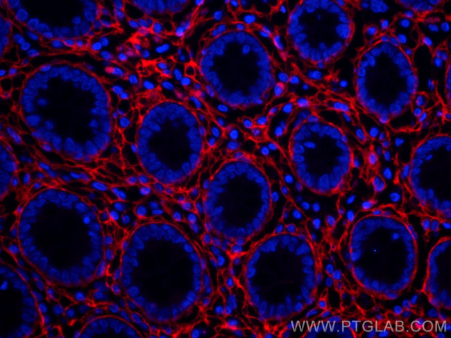Collagen Type III Antibody in Immunohistochemistry (Paraffin) (IHC (P))