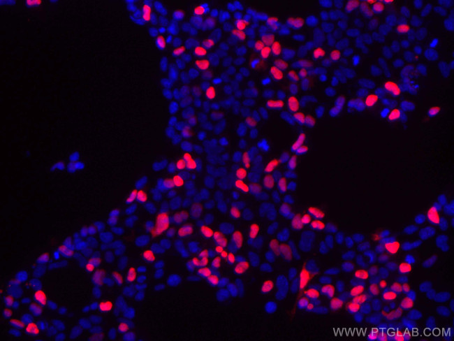 DYKDDDDK tag Antibody in Immunocytochemistry (ICC/IF)