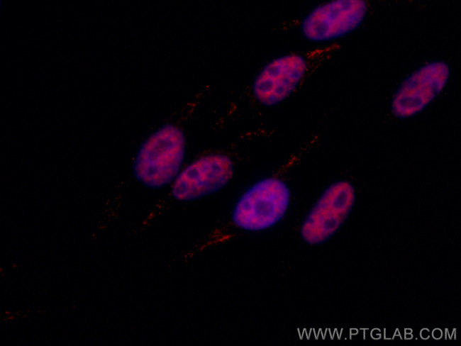 P53 Antibody in Immunocytochemistry (ICC/IF)