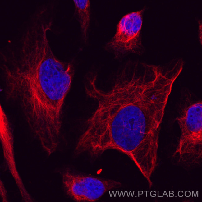 Vimentin Antibody in Immunocytochemistry (ICC/IF)