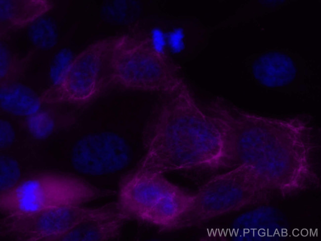 Cytokeratin 6A Antibody in Immunocytochemistry (ICC/IF)