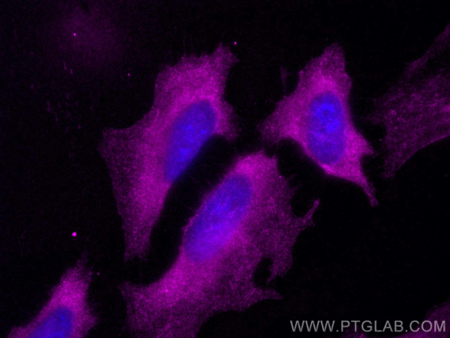 Septin 9 Antibody in Immunocytochemistry (ICC/IF)
