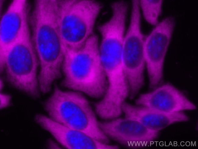 ENO1 Antibody in Immunocytochemistry (ICC/IF)