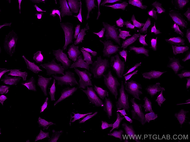VPRBP Antibody in Immunocytochemistry (ICC/IF)