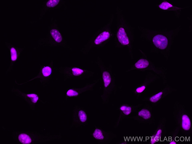 Cyclin E2 Antibody in Immunocytochemistry (ICC/IF)