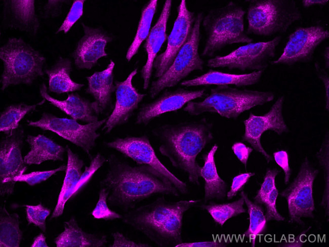 DRP1 Antibody in Immunocytochemistry (ICC/IF)
