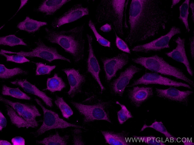 Septin 11 Antibody in Immunocytochemistry (ICC/IF)