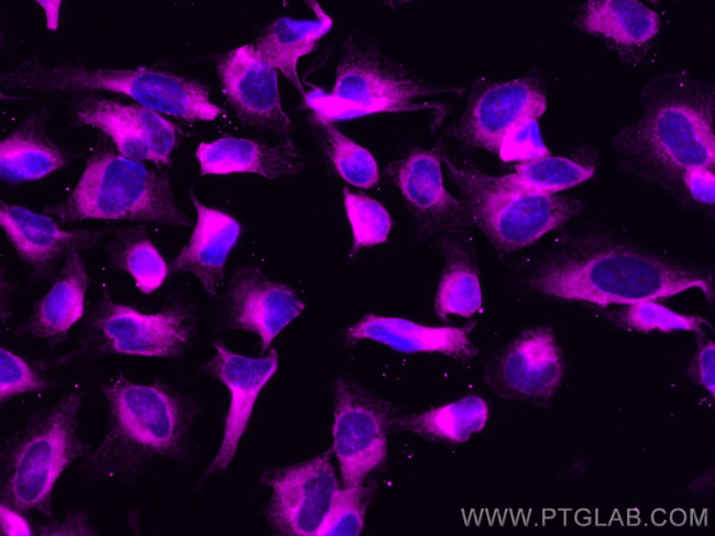 GRP94 Antibody in Immunocytochemistry (ICC/IF)