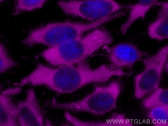 LDHB Antibody in Immunocytochemistry (ICC/IF)