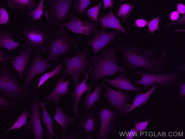 Thymidylate synthase Antibody in Immunocytochemistry (ICC/IF)