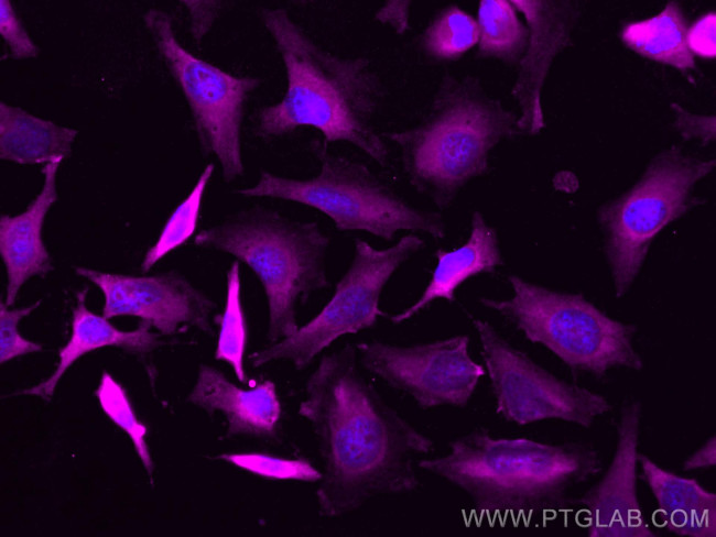 RABEPK/p40 Antibody in Immunocytochemistry (ICC/IF)