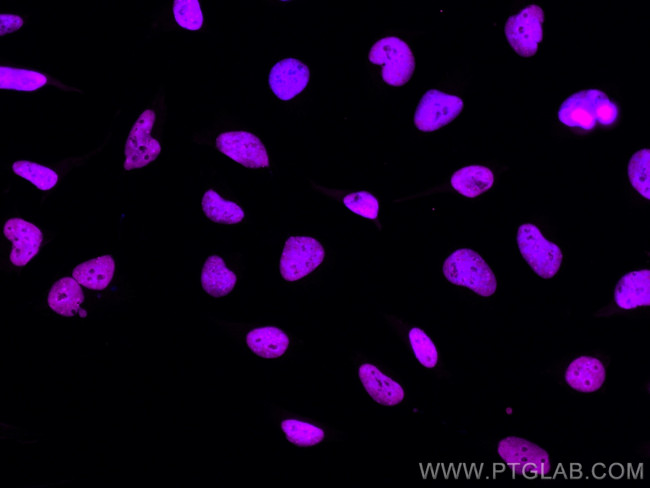 KAP1 Antibody in Immunocytochemistry (ICC/IF)