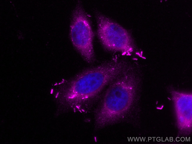 Transgelin-2 Antibody in Immunocytochemistry (ICC/IF)