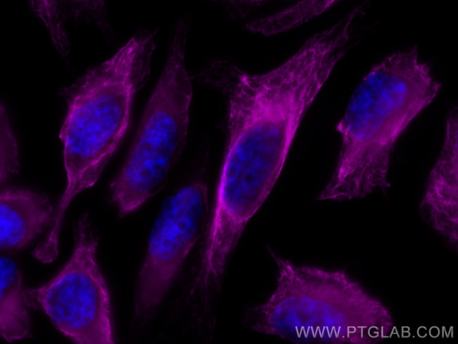 Cytokeratin 17 Antibody in Immunocytochemistry (ICC/IF)