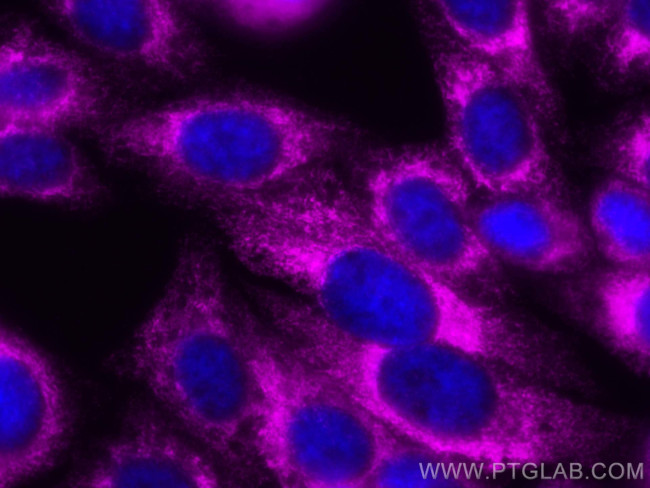 RRBP1 Antibody in Immunocytochemistry (ICC/IF)