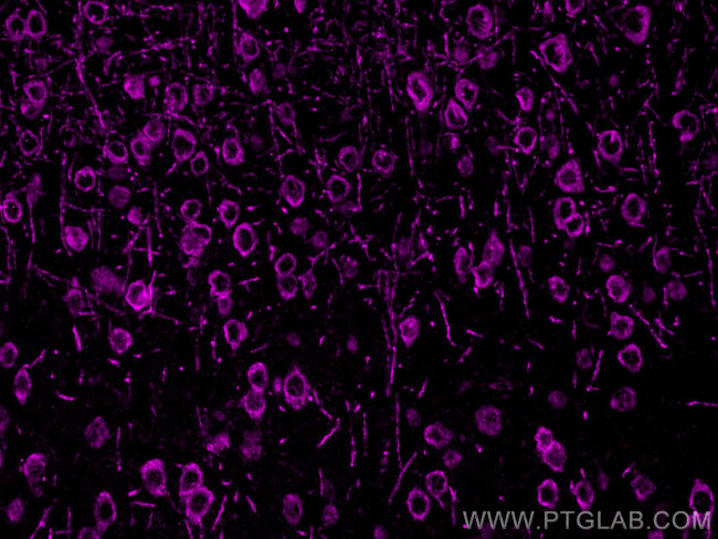 DLL3 Antibody in Immunohistochemistry (PFA fixed) (IHC (PFA))