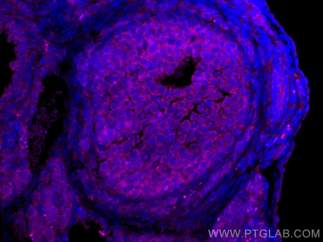 LHCGR Antibody in Immunohistochemistry (PFA fixed) (IHC (PFA))
