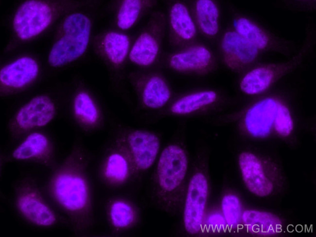 ERK1/2 Antibody in Immunocytochemistry (ICC/IF)