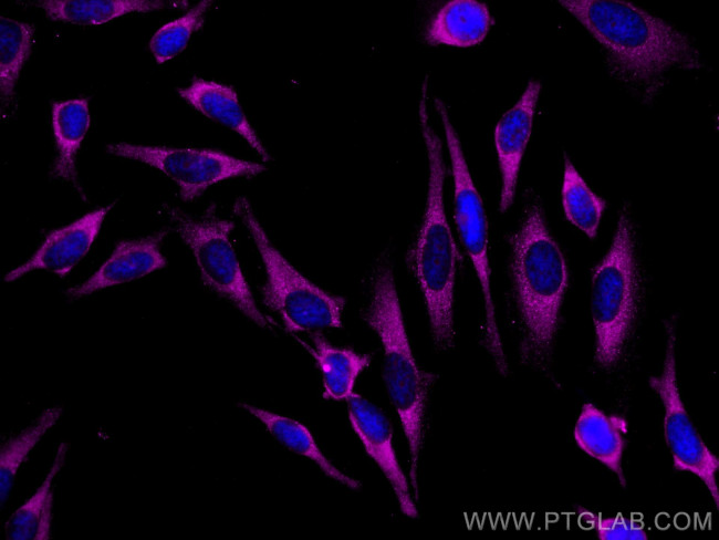 GDI2 Antibody in Immunocytochemistry (ICC/IF)