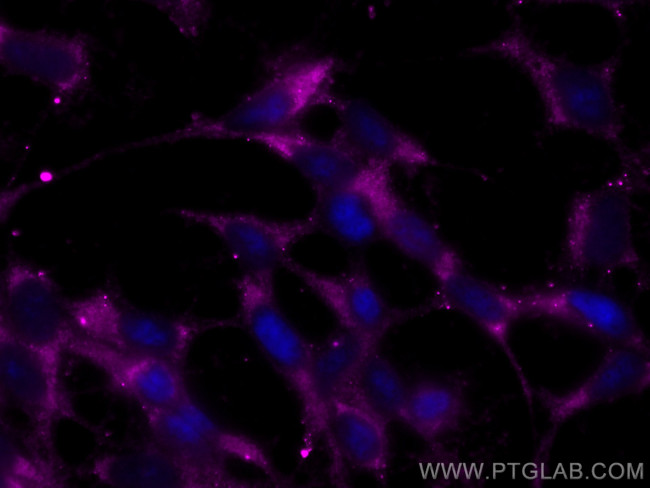 Chromogranin A Antibody in Immunocytochemistry (ICC/IF)