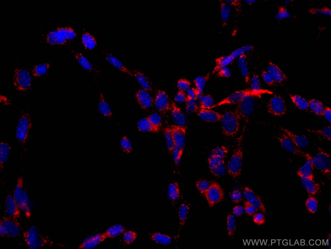 CD107a/LAMP1 Antibody in Immunocytochemistry (ICC/IF)