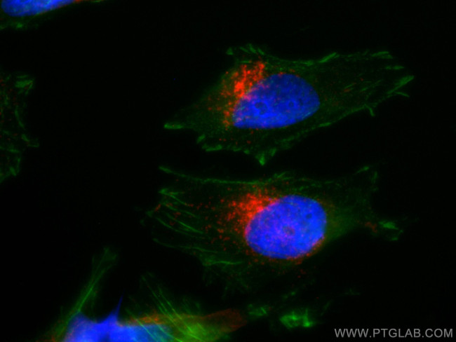 CD107a/LAMP1 Antibody in Immunocytochemistry (ICC/IF)