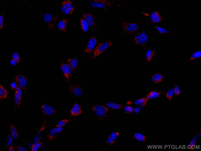 CD107b/LAMP2 Antibody in Immunocytochemistry (ICC/IF)
