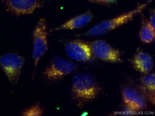 CD107b/LAMP2 Antibody in Immunocytochemistry (ICC/IF)
