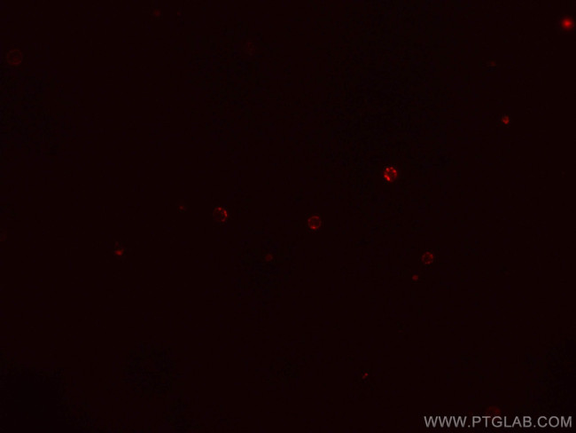 CD38 Antibody in Immunocytochemistry (ICC/IF)