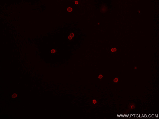 CD45 Antibody in Immunocytochemistry (ICC/IF)