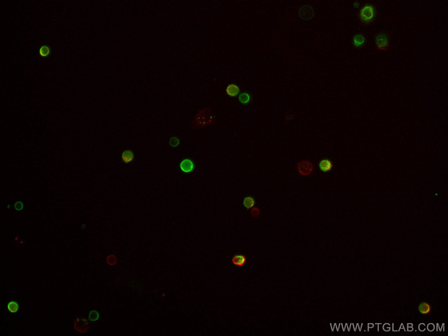 CD62L (L-Selectin) Antibody in Immunocytochemistry (ICC/IF)