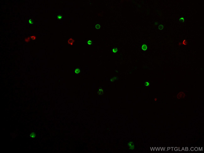 CD45R (B220) Antibody in Immunocytochemistry (ICC/IF)