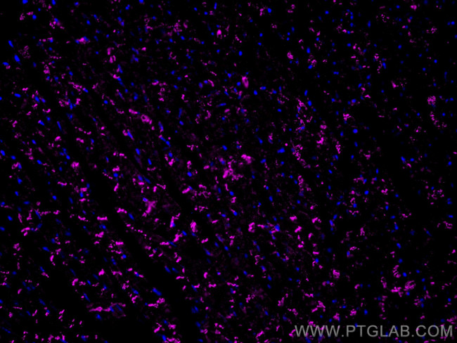 N-cadherin Antibody in Immunohistochemistry (PFA fixed) (IHC (PFA))