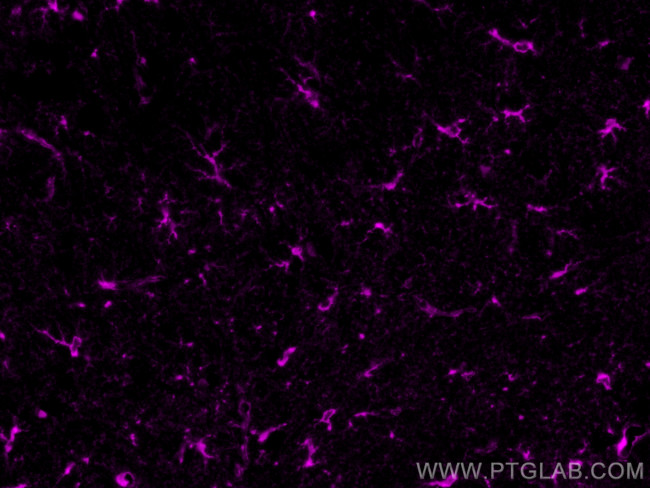 Glutamine Synthetase Antibody in Immunohistochemistry (PFA fixed) (IHC (PFA))