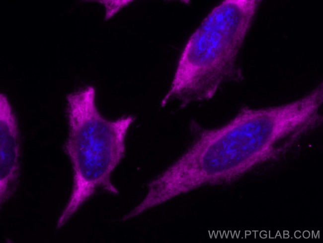 CAPRIN1 Antibody in Immunocytochemistry (ICC/IF)