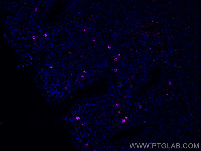 IgM Antibody in Immunohistochemistry (Paraffin) (IHC (P))