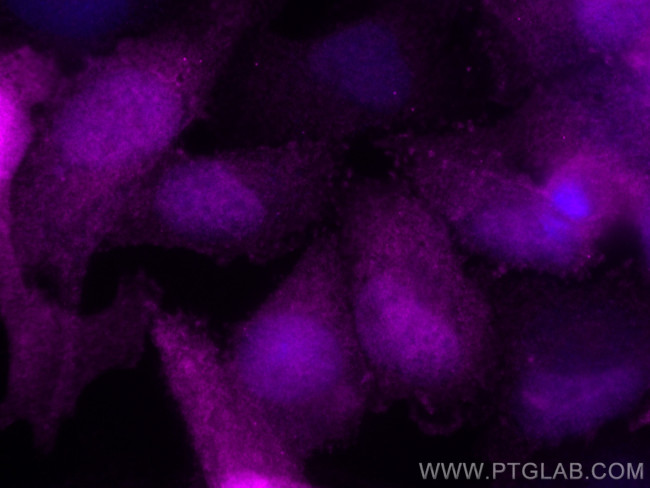 S100A4 Antibody in Immunocytochemistry (ICC/IF)