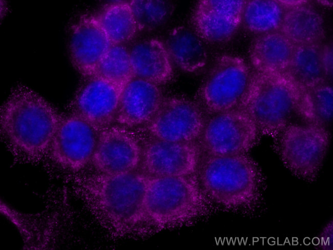 Decorin Antibody in Immunocytochemistry (ICC/IF)
