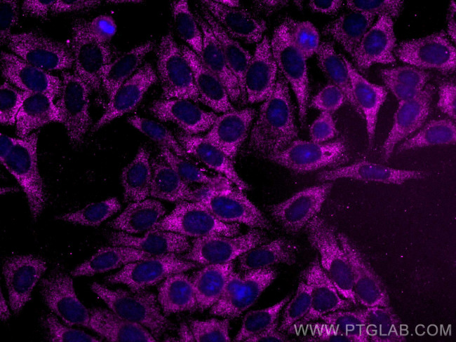 CAPN2 Antibody in Immunocytochemistry (ICC/IF)
