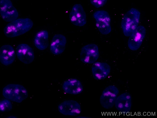 FBL Antibody in Immunocytochemistry (ICC/IF)