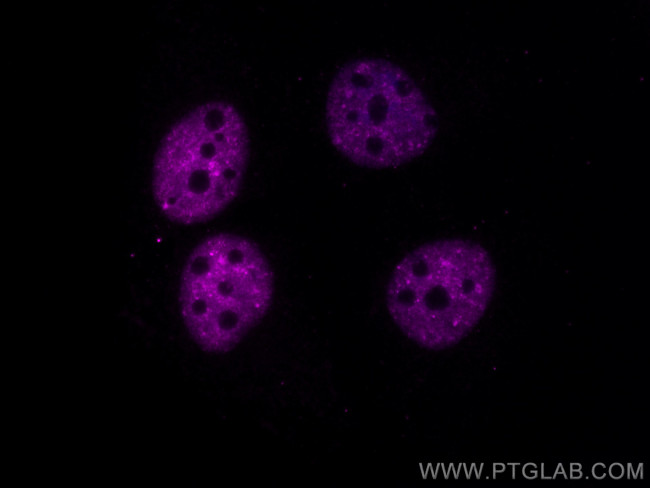TDP-43 Antibody in Immunocytochemistry (ICC/IF)