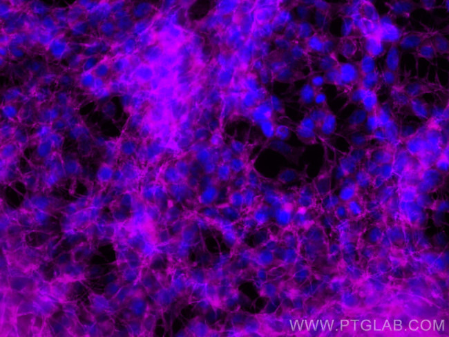 Drebrin Antibody in Immunocytochemistry (ICC/IF)