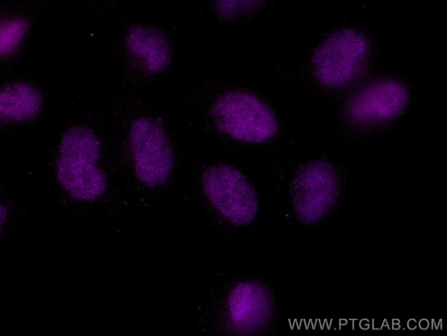 ANKRD1 Antibody in Immunocytochemistry (ICC/IF)